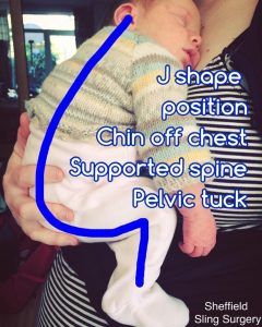 J shape position