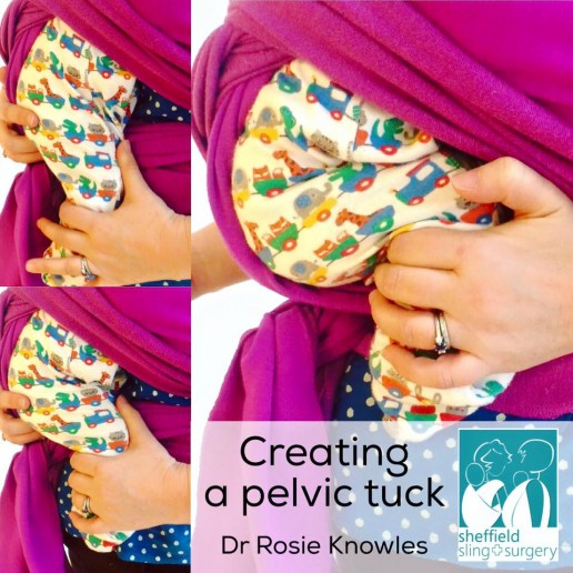 pelvic tuck