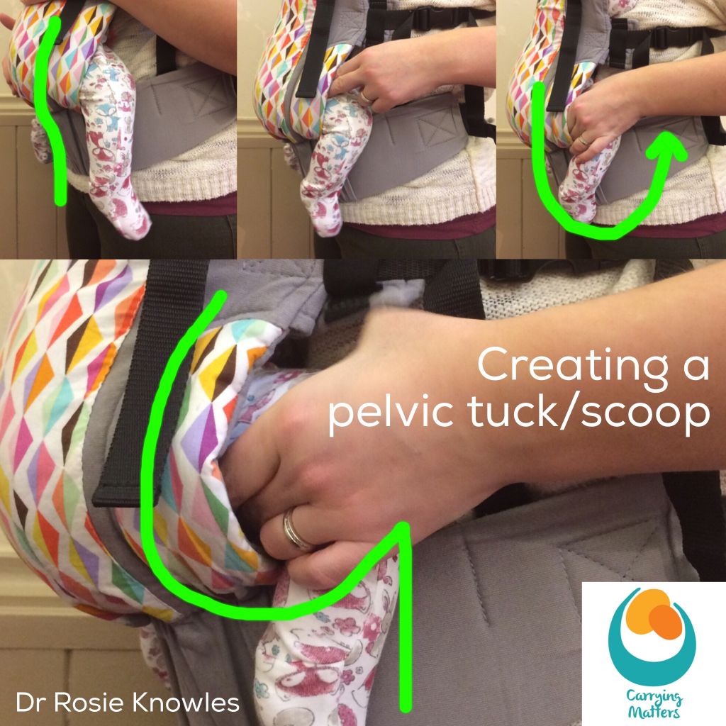 the pelvic tuck sling faqs